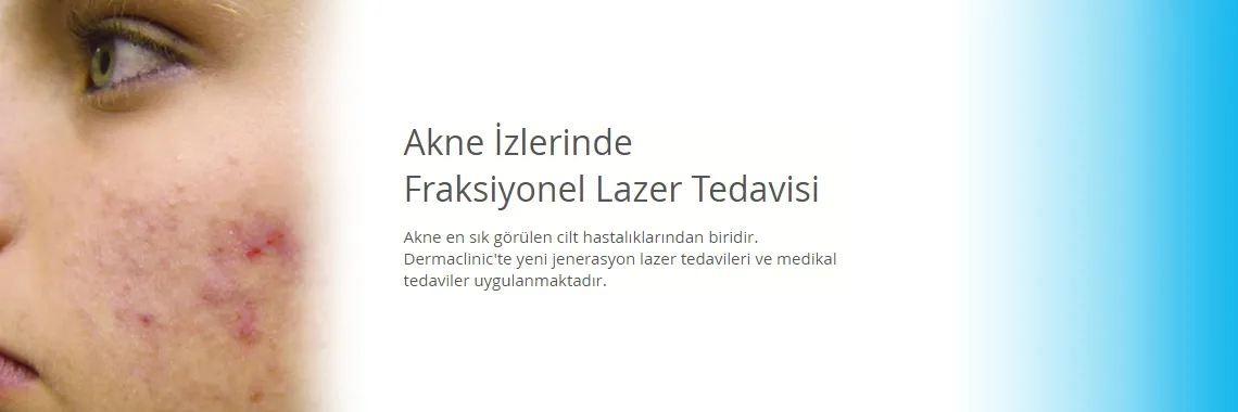 Bursa'da Cilt Lekeleri İçin Hangi Doktora Gidilir? Güneş, Yaşlılık ve Sivilce Lekelerinden Kurtulun