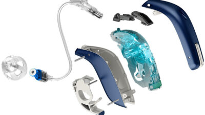 İşitme Cihazı; Kulakta çınlama, tıbbi adıyla tinnitus, birçok insanın yaşam