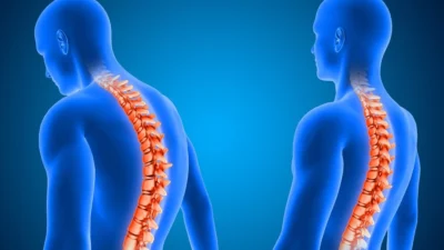 Omurga tümörlerinin hem kemik yapıyı hem de sinir dokusunu etkileyebileceğini