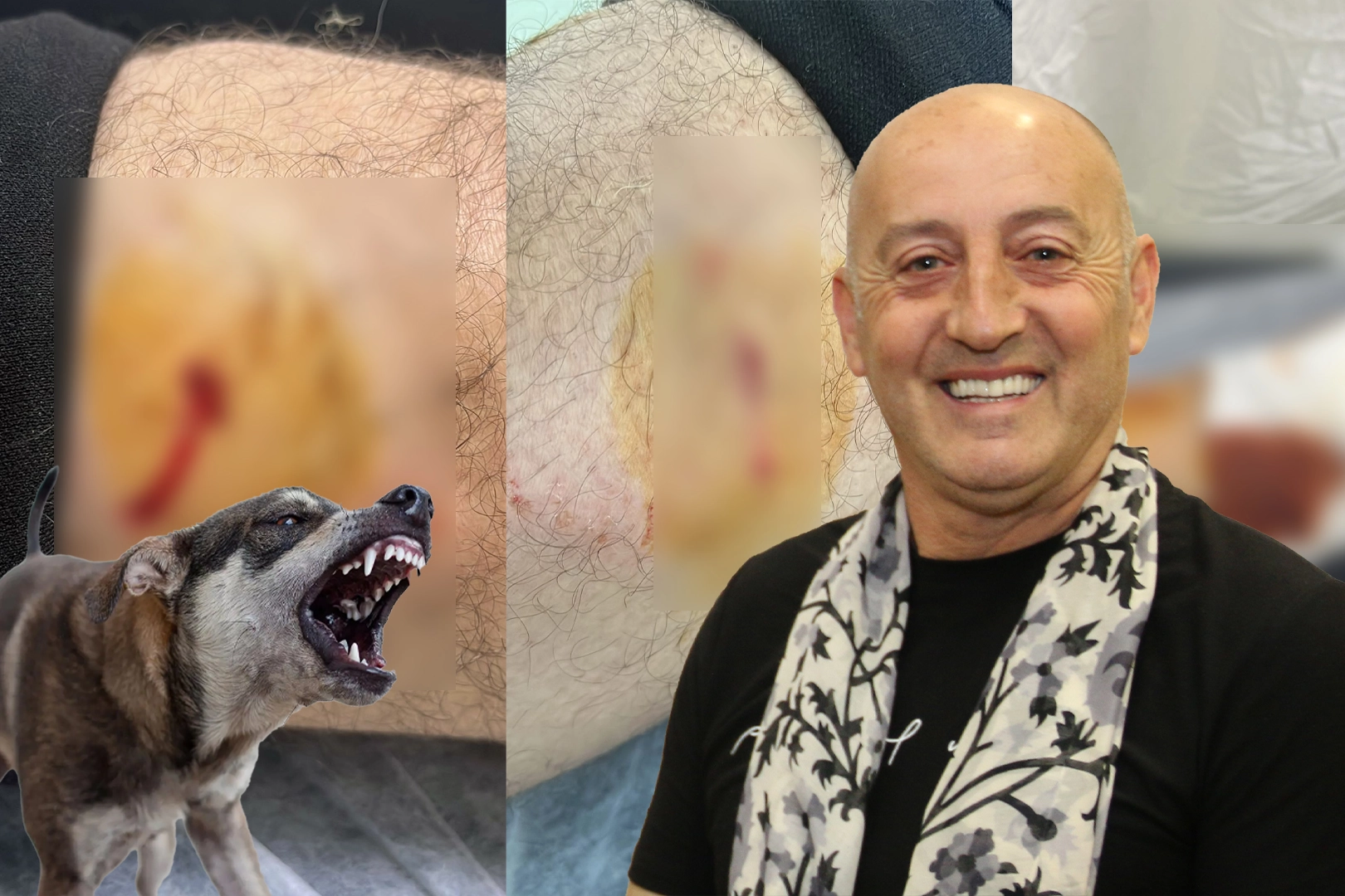 Bursa Gemlik’in Karacaali Mahallesi Muhtarı Göksal Noca, sokak köpeklerinin saldırısına